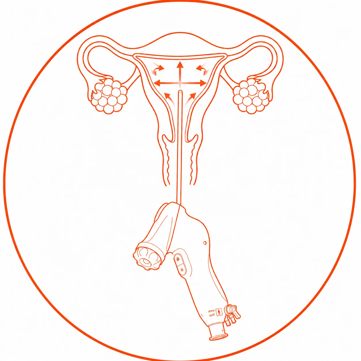 Effective Distension
