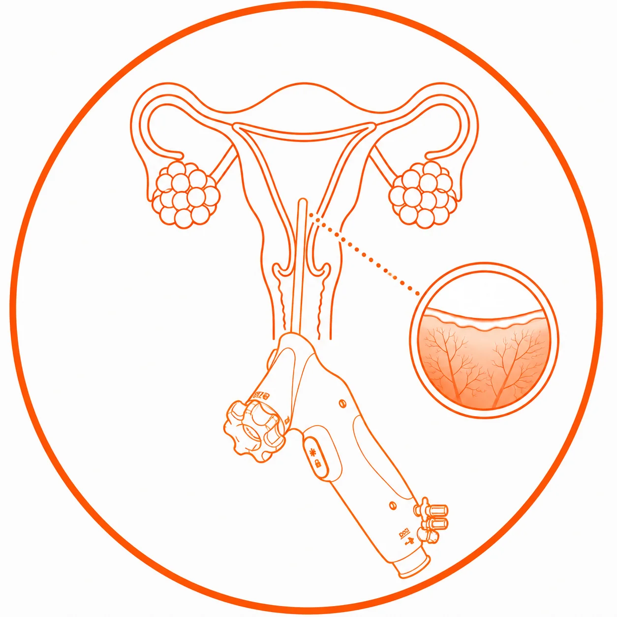 Instant Endometrial Vision