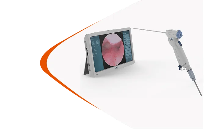 InterVu Office Hysteroscopy System